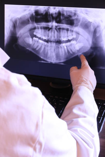 Best Emergency Dentist for Knocked-Out Tooth in Dano, CO